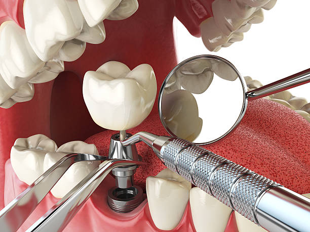 Best Emergency Broken Tooth Repair in Dale City, VA